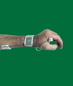 Orteza de mana dinamica